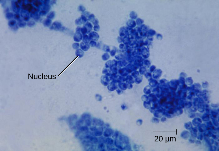 This work is a derivative of "Candida albicans" by CDC/ Dr. Gordon Roberstad, https://cnx.org/contents/y54zcuVm@1/Characteristics-of-Fungi, licensed under CC0 Photomicrograph of the fungus Candida albicans, with nucleus labeled.