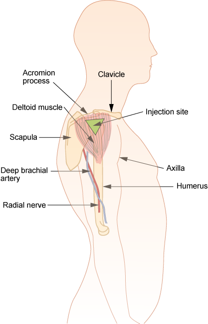 “Im-deltoid.png” by British Columbia Institute of Technology (BCIT) is licensed under CC BY 4.0. Access for free at https://opentextbc.ca/clinicalskills/chapter/6-7-intradermal-subcutaneous-and-intramuscular-injections/ Illustration showing how to Locate the Deltoid Injection Site