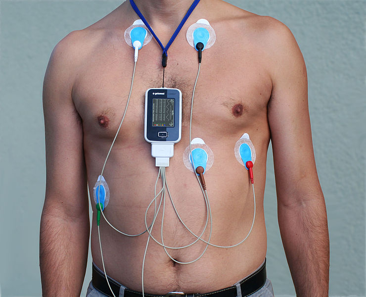 ”Alex_CM4000.jpg” by Misscurry is licensed under CC BY-SA 3.0 Photo showing patient on telemetry