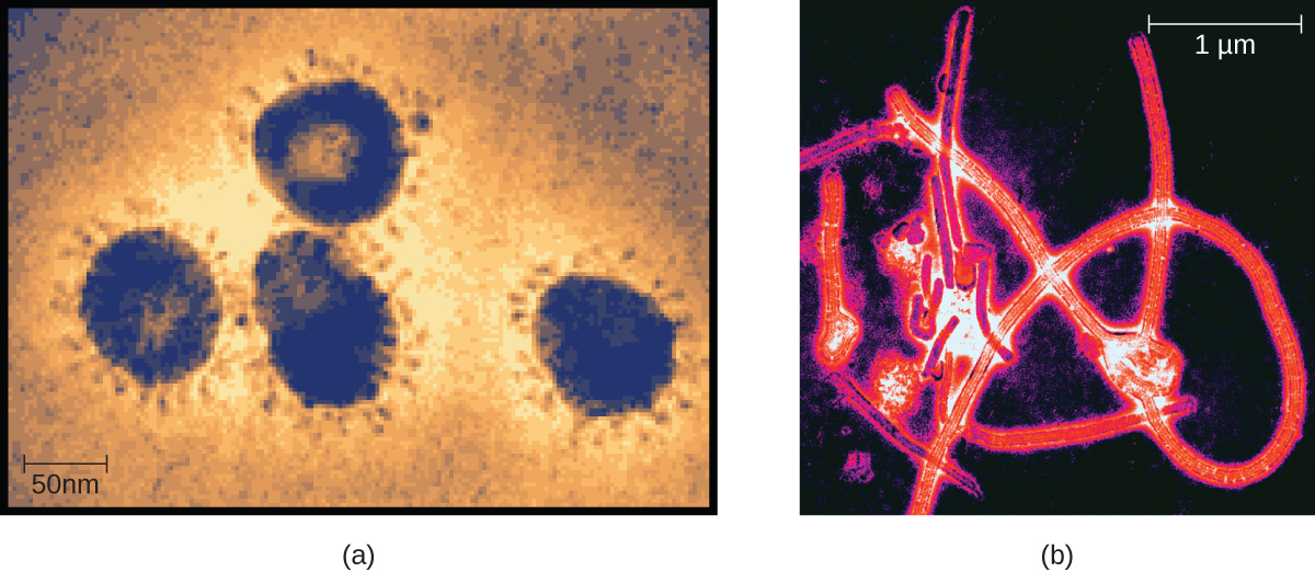 "Unknown" by CNX OpenStax is licensed under CC BY 4.0 Access for free at https://openstax.org/books/microbiology/pages/1-3-types-of-microorganisms Photos of viruses. The first photo shows members of the Coronavirus family. The second photo shows the Ebolavirus, a member of the Filovirus family.