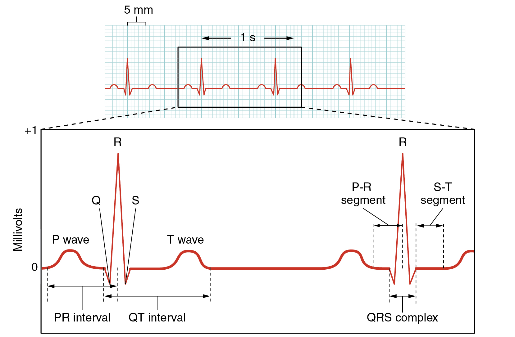 "Electrocardiogram Depolarization.jpg" by OpenStax College is licensed under CC BY 4.0 Access for free at https://openstax.org/books/anatomy-and-physiology/pages/19-2-cardiac-muscle-and-electrical-activity Illustration, with labels, showing an electrocardiogram tracing.
